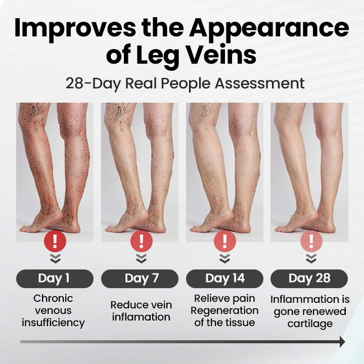 Ptyalial® Leg Vein Magnet Ankle Bracelet