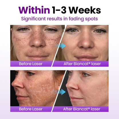 Ptyalial® SpotErase Probiotic Shield Serum