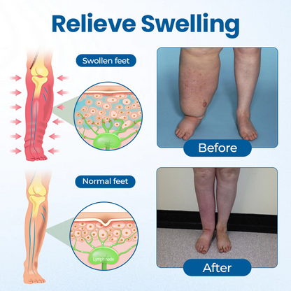 Mayo Clinic recommends👨‍⚕️: Lymphora Swelling Relief Roll-On