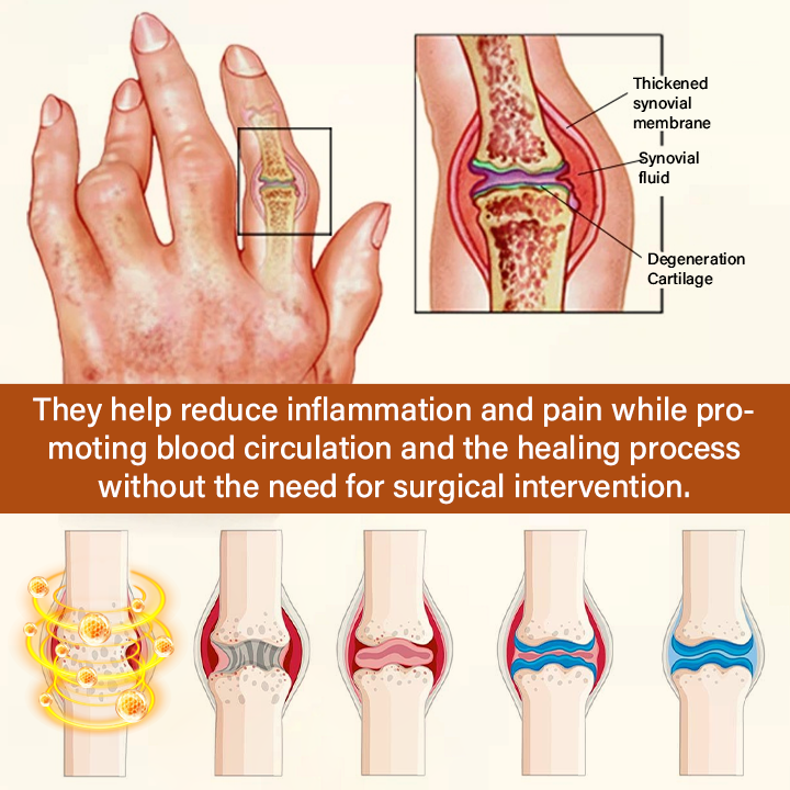 Made and Shipped from USA ✨TUMLY® VenomEase Joint Cream(AAD Recommended👨‍⚕️)