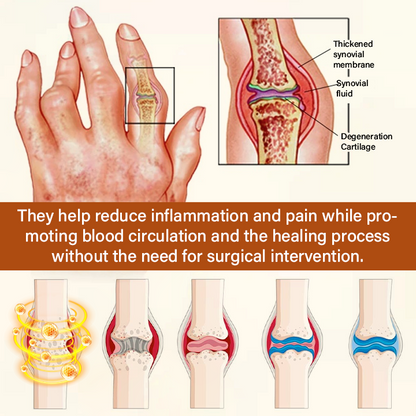 Made and Shipped from USA ✨TUMLY® VenomEase Joint Cream(AAD Recommended👨‍⚕️)