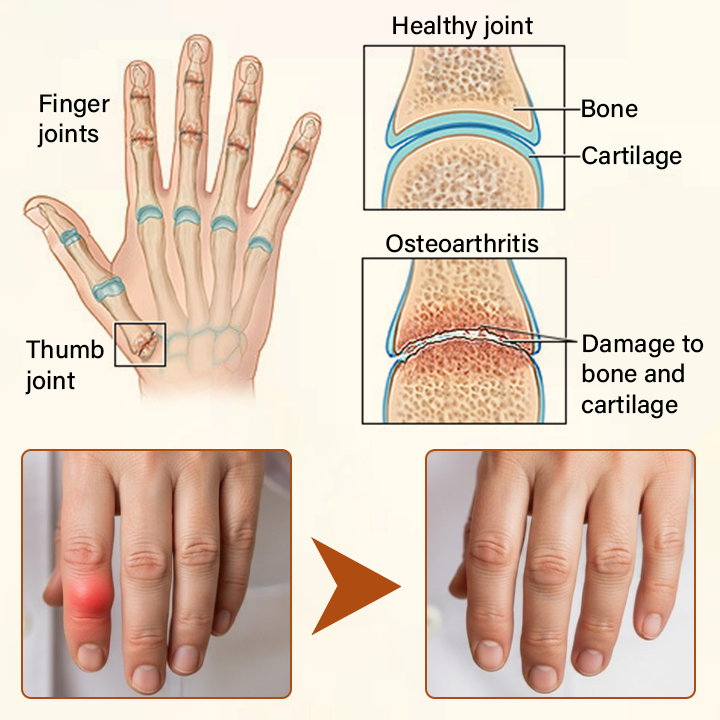 Made and Shipped from USA ✨TUMLY® VenomEase Joint Cream(AAD Recommended👨‍⚕️)