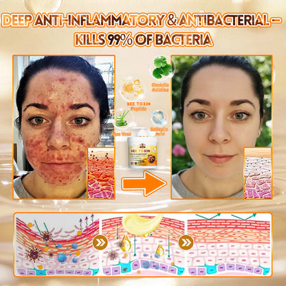 🐝🔥FDA Approved| Ptyalial® Bee toxin Skin Restoration Cream (Anti-aging, Hydrating, Skin Repair, Even Tone, Acne and Dark Spot Treatment, Wart and Mole Removal, Psoriasis Relief)