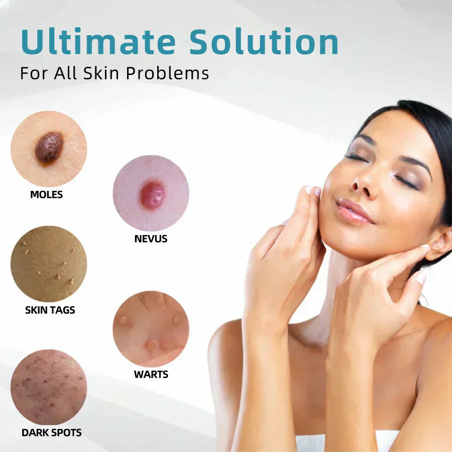 ✨Ptyalial™ All-in-One CO₂ Laser Eraser Pen | Removes Moles, Warts, Skin Flaws & Pigmentation