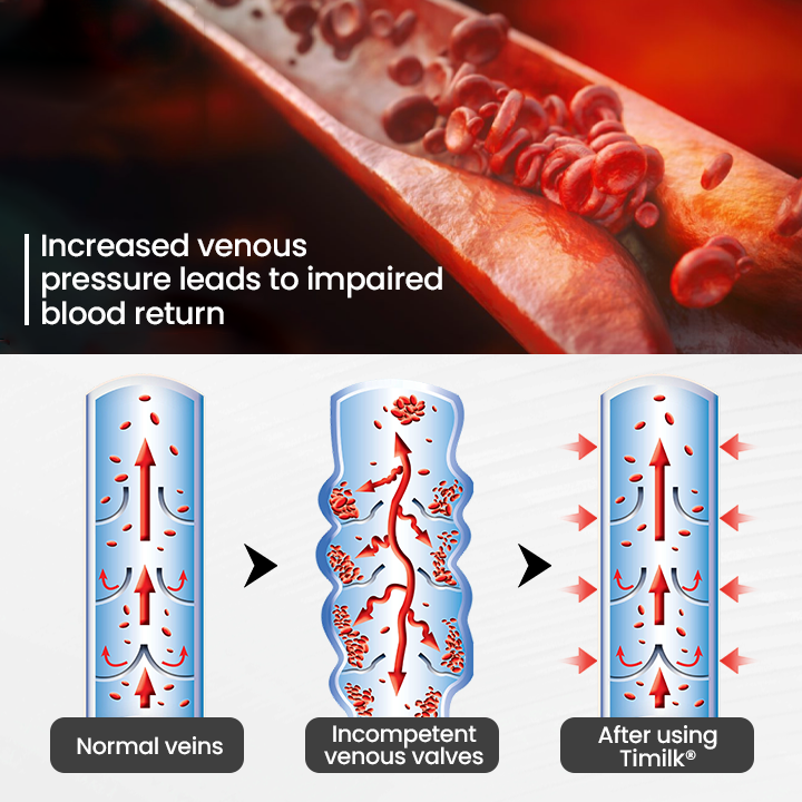 Ptyalial® Leg Vein Magnet Ankle Bracelet