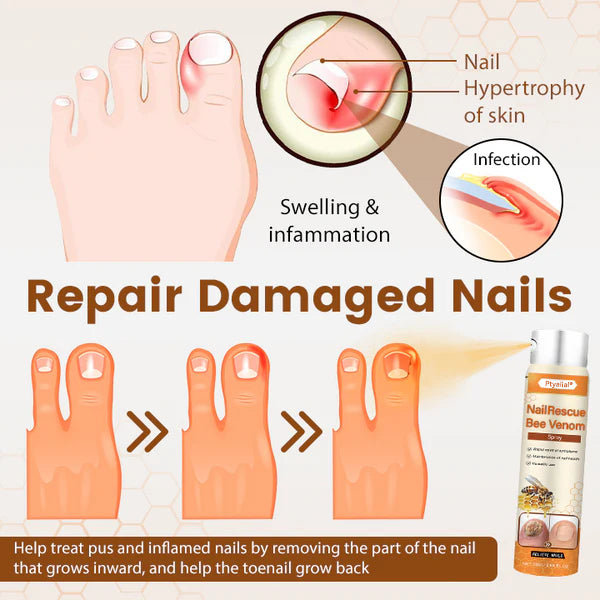 Ptyalial® NailRescue Bee Venom Spray