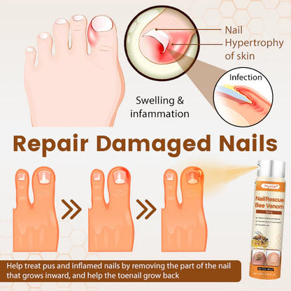 Ptyalial® NailRescue Bee Venom Spray
