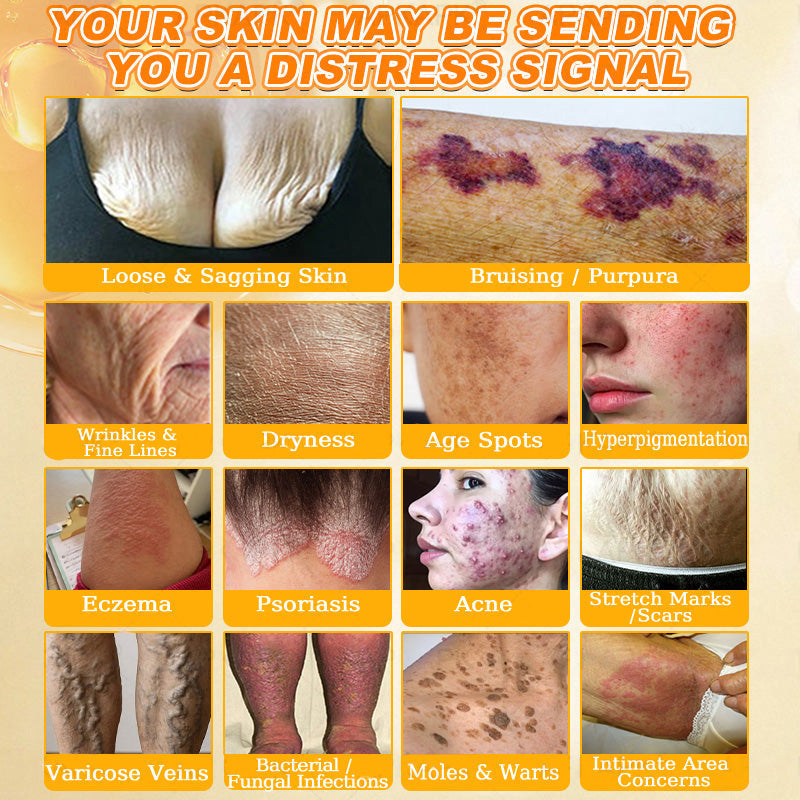 🐝🔥FDA Approved| Ptyalial® Bee toxin Skin Restoration Cream (Anti-aging, Hydrating, Skin Repair, Even Tone, Acne and Dark Spot Treatment, Wart and Mole Removal, Psoriasis Relief)