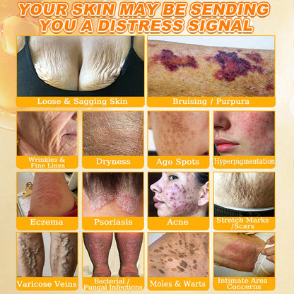 🐝🔥FDA Approved| Ptyalial® Bee toxin Skin Restoration Cream (Anti-aging, Hydrating, Skin Repair, Even Tone, Acne and Dark Spot Treatment, Wart and Mole Removal, Psoriasis Relief)