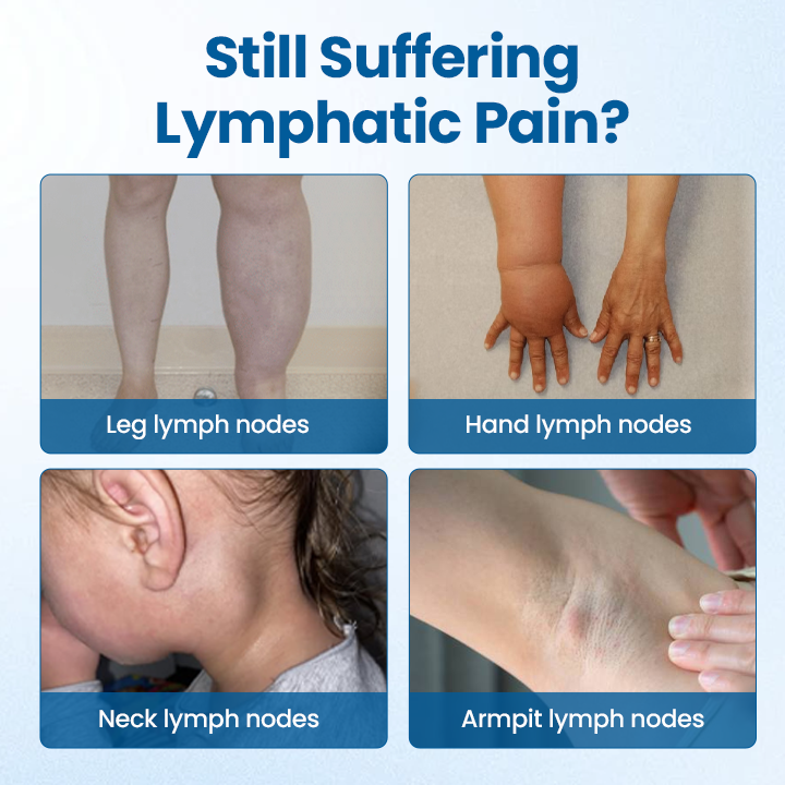 Mayo Clinic recommends👨‍⚕️: Lymphora Swelling Relief Roll-On