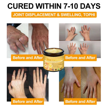 Mayo Clinic recommends👨‍⚕️: Bee Venom Advanced Joint and Bone Healing Cream
