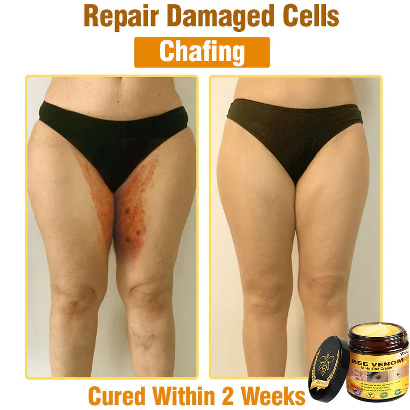 Bee Venom All-in-One Cream US Dermatologist Approved🐝