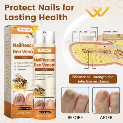 Ptyalial® NailRescue Bee Venom Spray