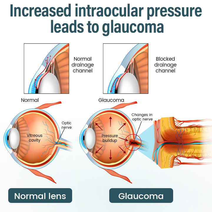 Mayo Clinic recommends👨‍⚕️: OptiFusion Nano Eye Drops Serum