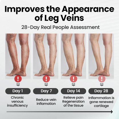 Ptyalial® Leg Vein Magnet Ankle Bracelet