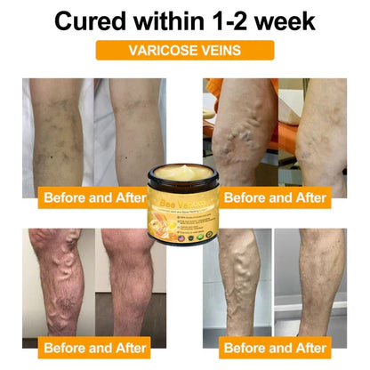 Mayo Clinic recommends👨‍⚕️: Bee Venom Advanced Joint and Bone Healing Cream