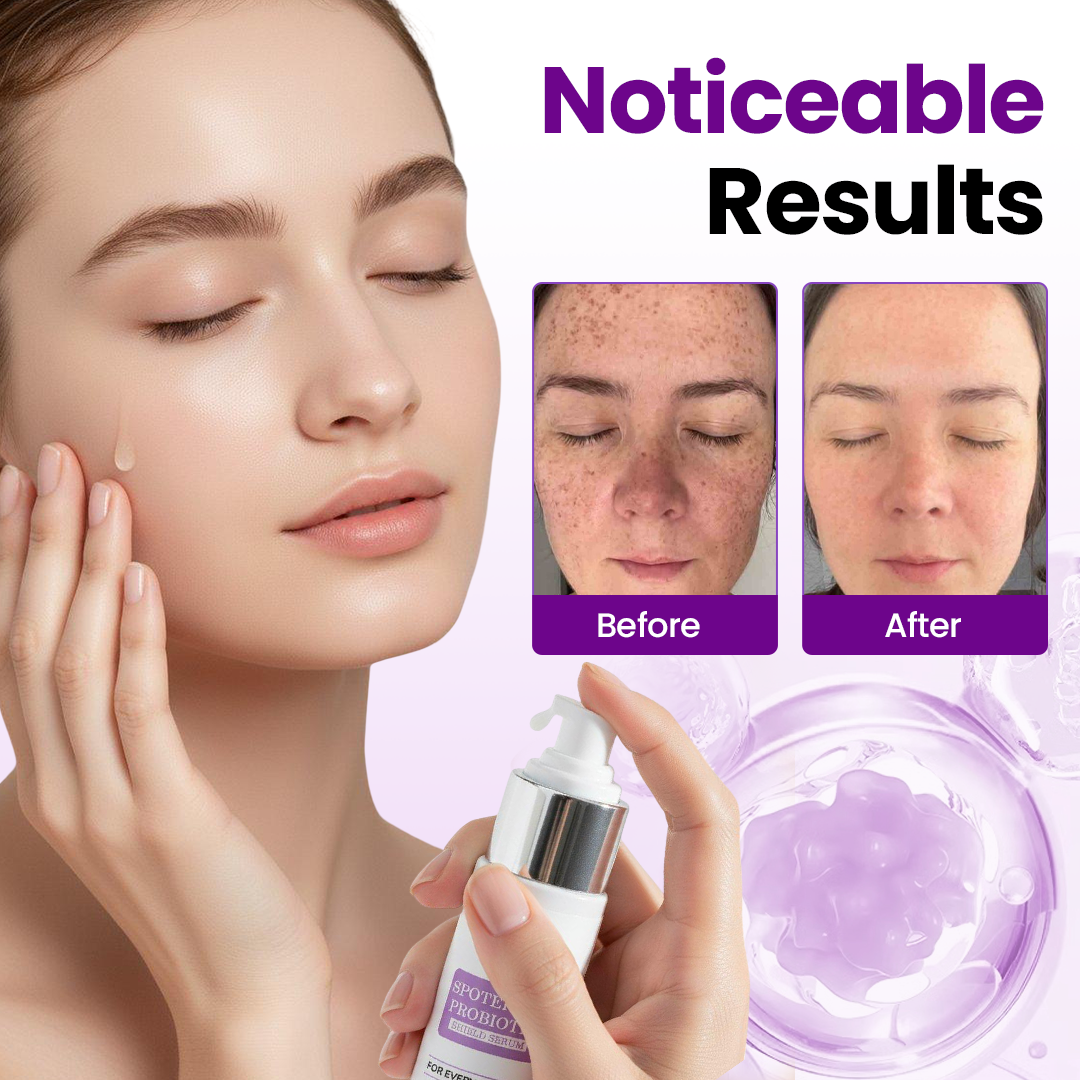 Ptyalial® SpotErase Probiotic Shield Serum