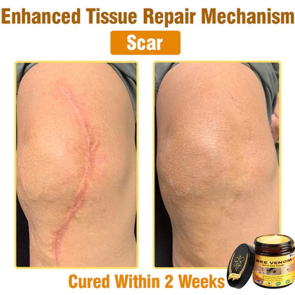 Bee Venom All-in-One Cream US Dermatologist Approved🐝