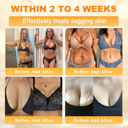 🐝🔥FDA Approved| Ptyalial® Bee toxin Skin Restoration Cream (Anti-aging, Hydrating, Skin Repair, Even Tone, Acne and Dark Spot Treatment, Wart and Mole Removal, Psoriasis Relief)