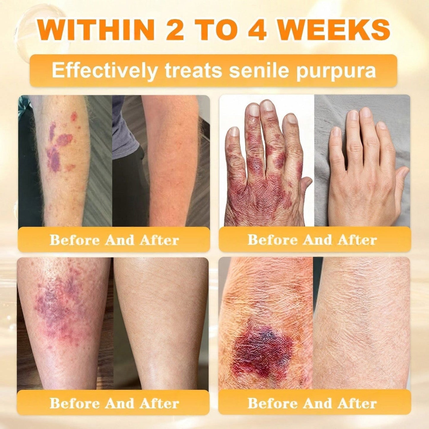 🐝🔥FDA Approved| Ptyalial® Bee toxin Skin Restoration Cream (Anti-aging, Hydrating, Skin Repair, Even Tone, Acne and Dark Spot Treatment, Wart and Mole Removal, Psoriasis Relief)