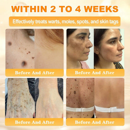 🐝🔥FDA Approved| Ptyalial® Bee toxin Skin Restoration Cream (Anti-aging, Hydrating, Skin Repair, Even Tone, Acne and Dark Spot Treatment, Wart and Mole Removal, Psoriasis Relief)